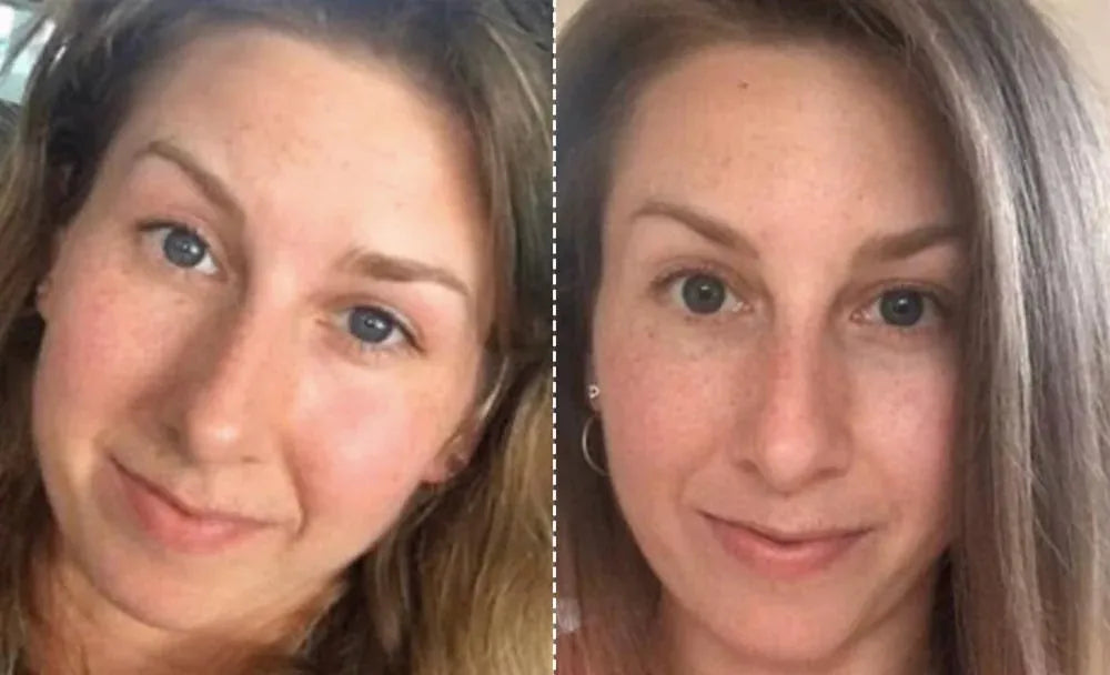 EMS Facial Mask