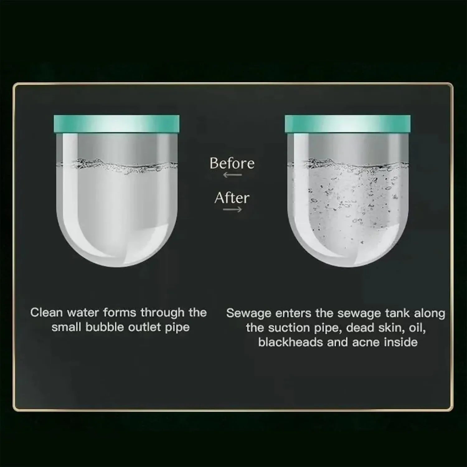 Hydro Dermabrasio