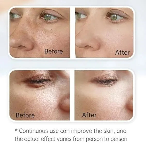 Advanced Hydra H3 Microneedling Pen