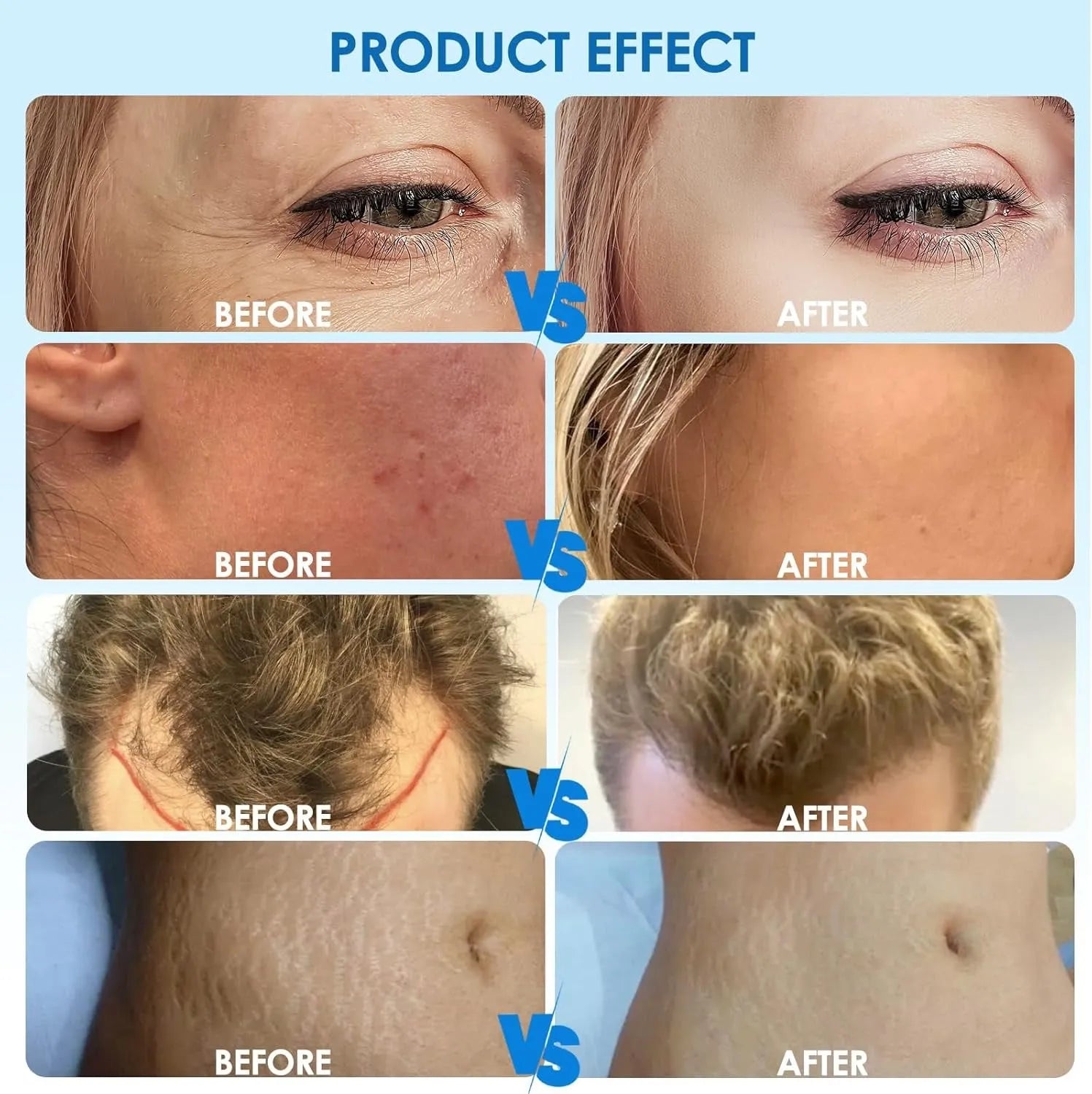 Advanced Hydra H3 Microneedling Pen