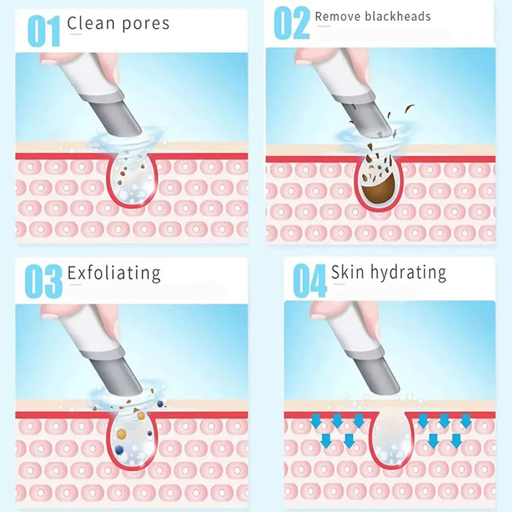 Hydrodermabrazja do twarzy