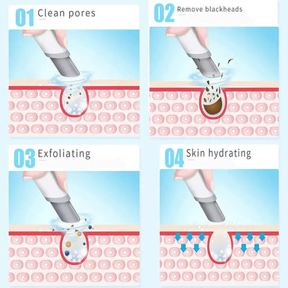 Hydrodermabrazja do twarzy