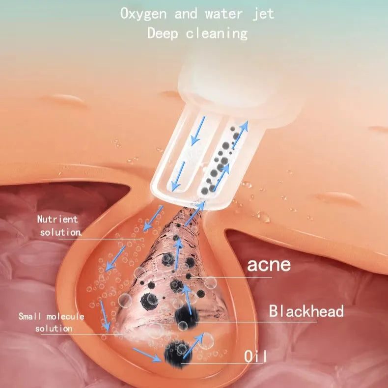Hydro Dermabrasion Facial Machine