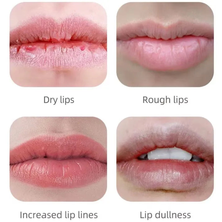 Lip Light Therapy and Teeth Whitening Device