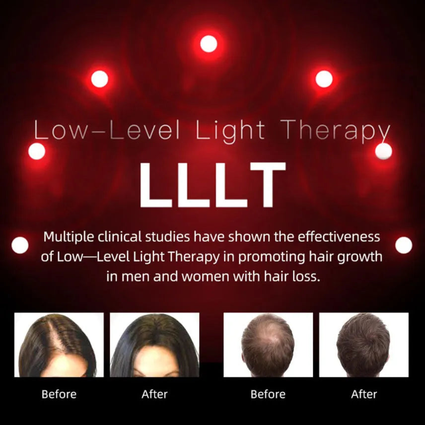 LED Hair Growth Helmet
